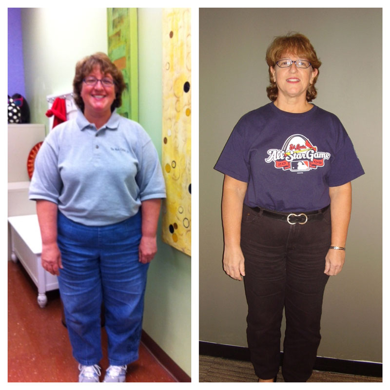 kathy-beforeafteroct2013